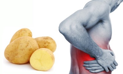 Cáscara de papas para los cálculos renales