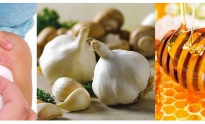Cómo hacer antisépticos caseros