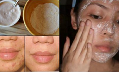 Mascarilla para manchas y arrugas en la cara