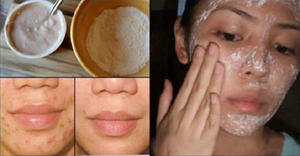 Mascarilla para manchas y arrugas en la cara