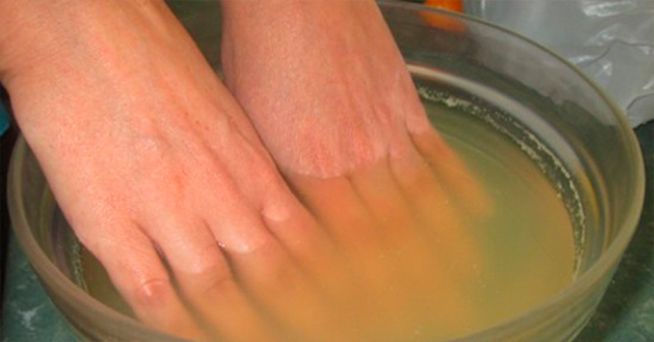 Cómo aliviar el dolor de artritis en las manos