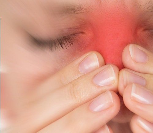 Jugos para curar la sinusitis