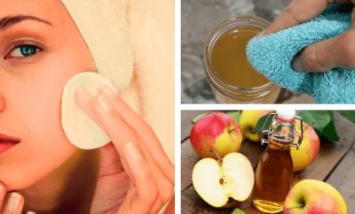 Beneficios del vinagre de manzana para el rostro