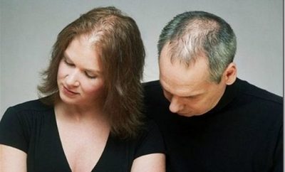Cómo combatir la alopecia de forma natural