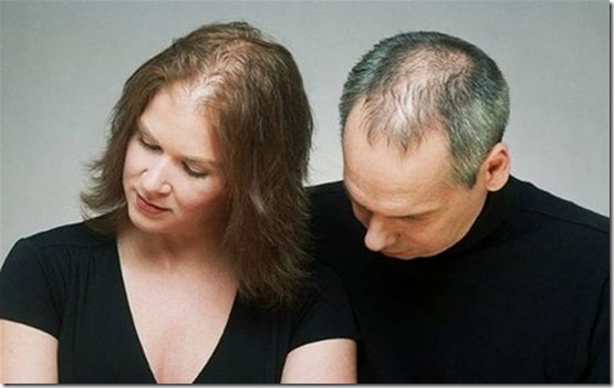 Cómo combatir la alopecia de forma natural