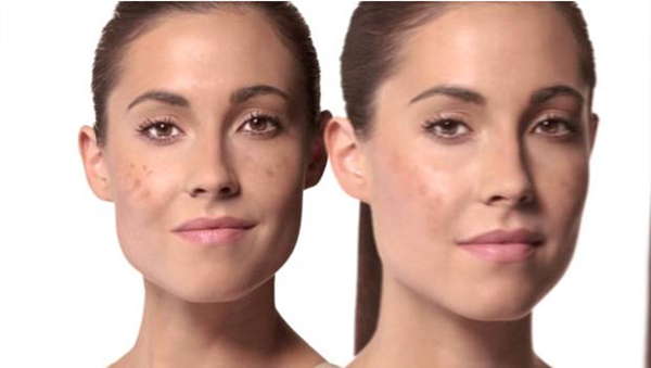 Cómo eliminar manchas y pecas en la cara