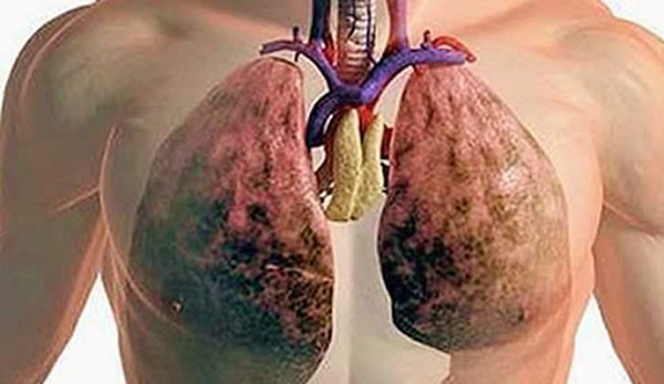 Cómo limpiar los pulmones de la nicotina