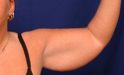 Cómo quemar grasa del abdomen y brazos