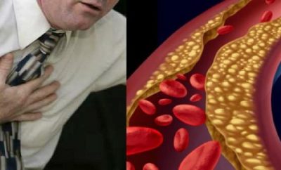 Remedio natural para limpiar las arterias del corazón
