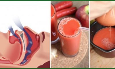 Cómo dejar de roncar de forma natural