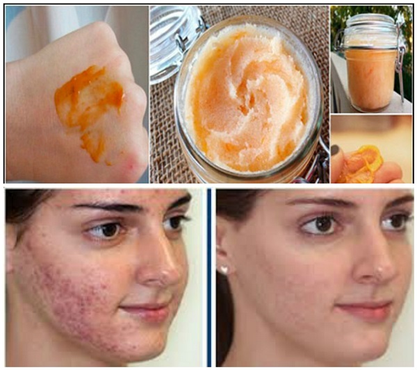 Mascarilla de mandarina para el acné