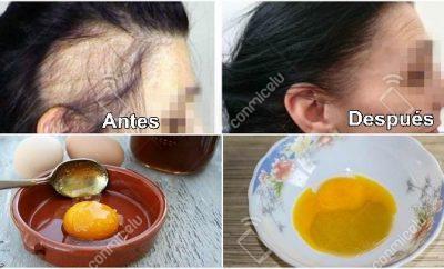 Receta para la caída del cabello