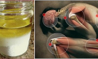 Tratamiento natural para la Osteocondrosis