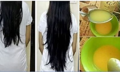 Crema para acelerar el crecimiento del cabello