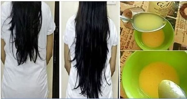 crema para acelerar el crecimiento del cabello