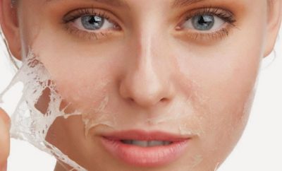 Cuidados después de un peeling quimico facial