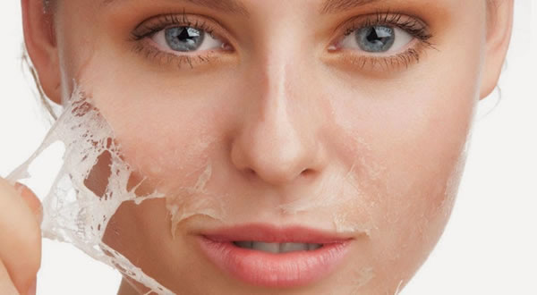 Cuidados después de un peeling quimico facial