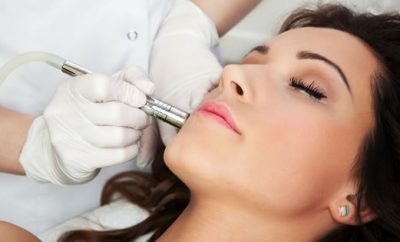 Microdermoabrasión facial