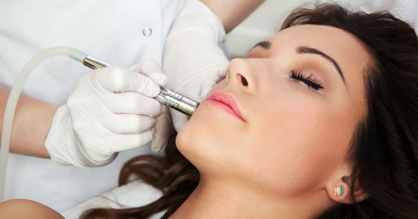 microdermoabrasión facial