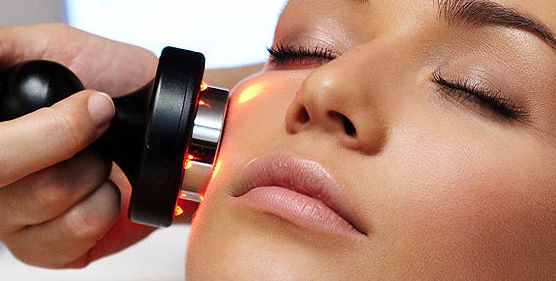 Rejuvenecimiento facial con radiofrecuencia