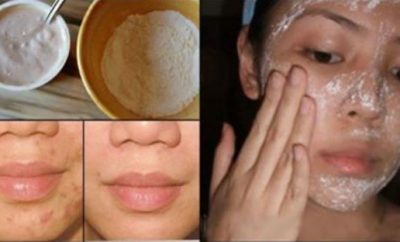 Crema casera para regenerar la piel