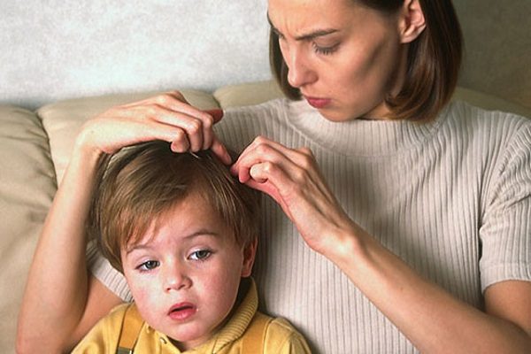 cómo eliminar piojos y liendres de forma natural