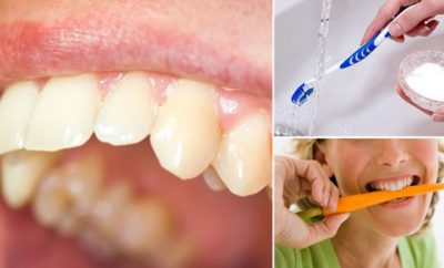 como-quitar-el-sarro-en-los-dientes-naturalmente