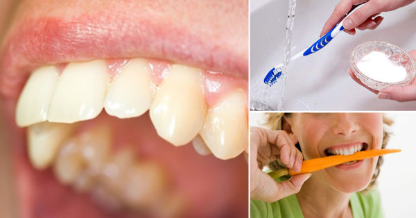 cómo quitar el sarro en los dientes naturalmente