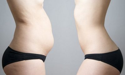 remedio efectivo para eliminar la grasa abdominal