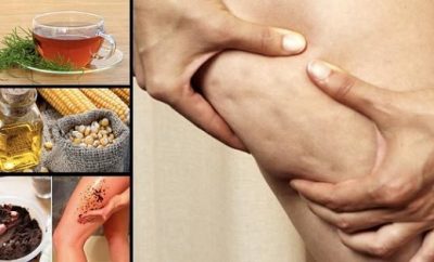 remedios-caseros-para-eliminar-la-celulitis