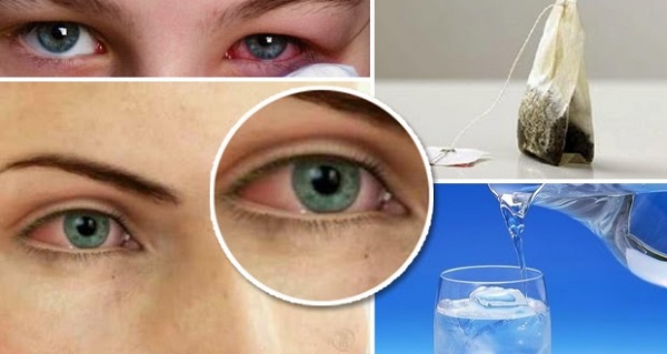 como aliviar la irritacion de los ojos, recetas